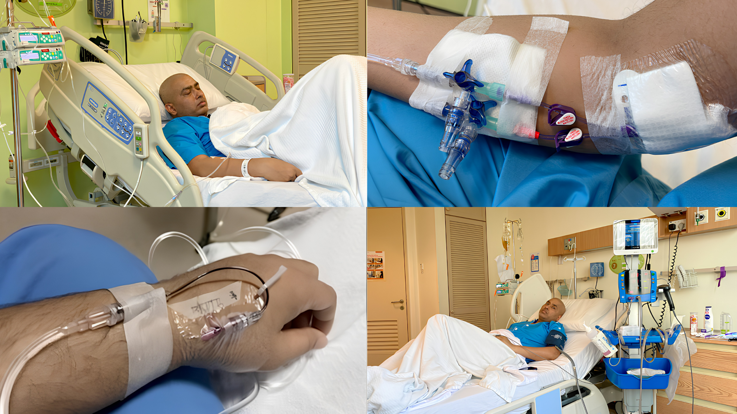 chữa bệnh ung thư máu bằng tế bào gốc