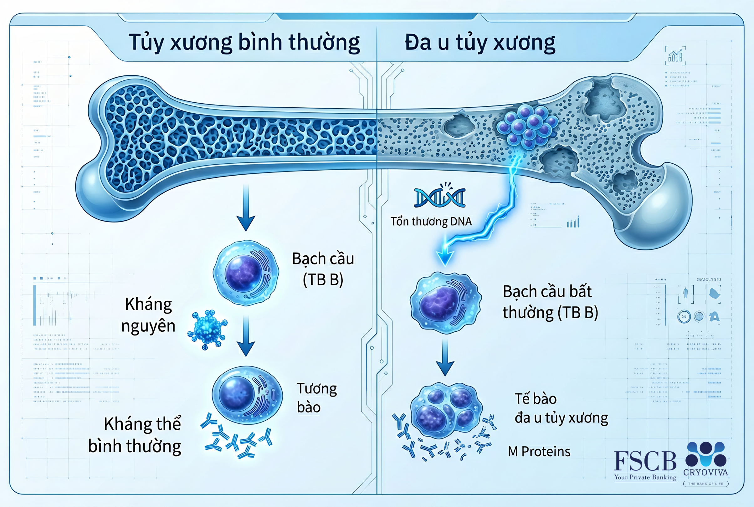 ung thư máu đa u tuỷ xương